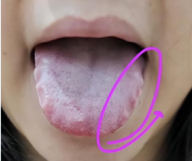 我见不得大家走弯路！很多人的外阴白斑就像连环车祸，环环相扣！