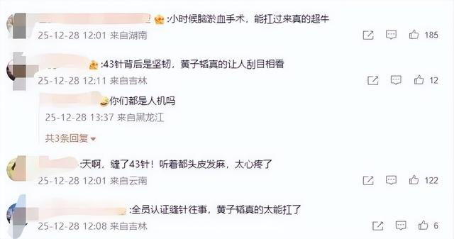 冲上热搜！黄子韬因脑淤血接受开颅手术缝了43针	，本人回应