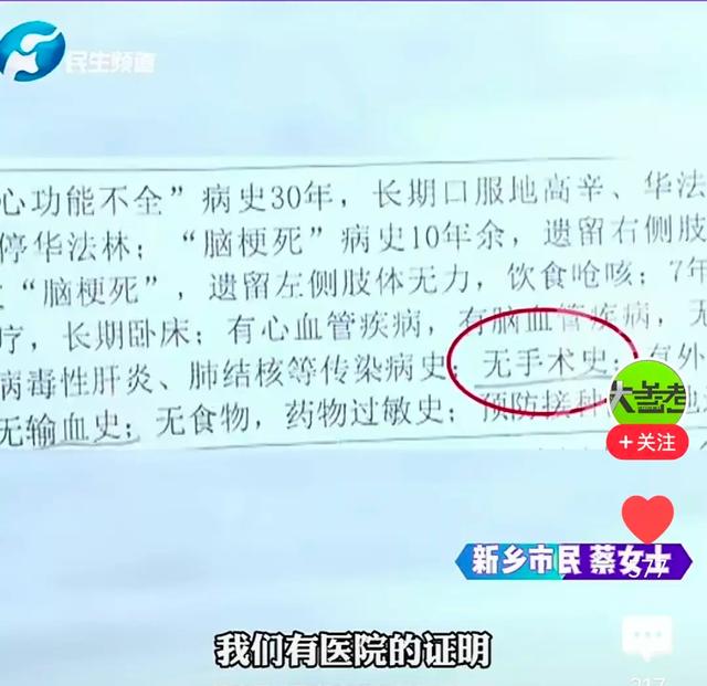 骨灰现四根钢钉后续：CT查无金属异物，监控视频是断续的！