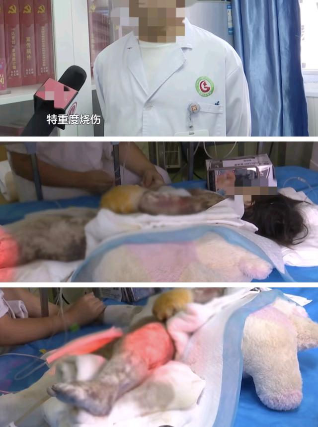 2岁女童跌入开水锅！70%烫伤背后，三秒疏忽一生伤痛