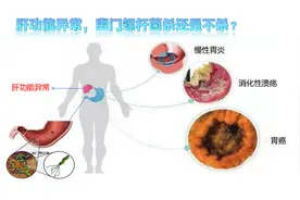 肝功能异常，幽门螺杆菌杀还是不杀？图片