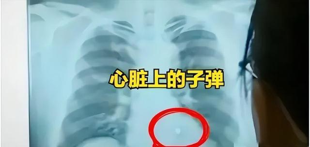 第三世界大战导火索？斯洛伐克总理身中多枪，凶手身份曝光！