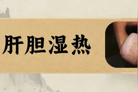 春分至，一款中成药清肝利胆、祛湿除邪！图片