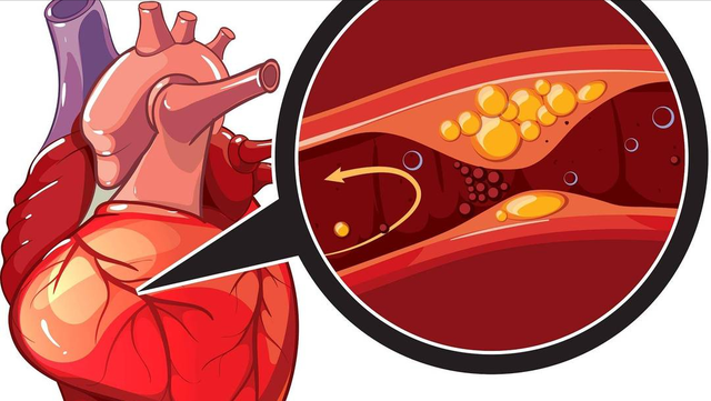 人有没有心梗，散步就知道？得心梗的人，散步常有这5个表现