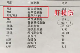 肝好不好，看这3项指标，正常说明无大碍图片