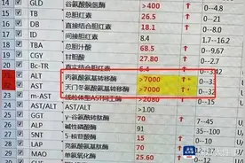 深圳女孩85斤嫌太胖！吃减肥药造成肝衰竭，医生下病危通知图片