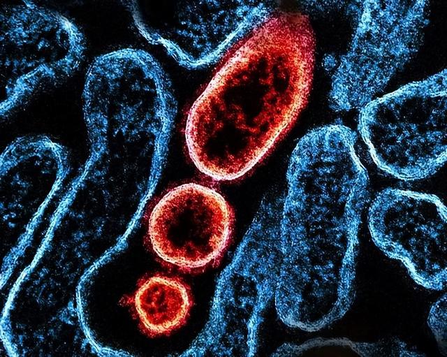 “尼帕病毒”来势汹汹，呼吁：每家备好5样东西	，关键时刻能救命