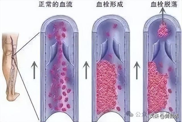 “门闩”还是“门栓”？“闩”和“栓”的用法有什么区别？