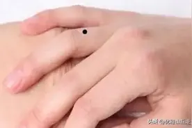 痣相决定命运？这五颗痣让你无论男女都走上人生巅峰！看看你有吗图片