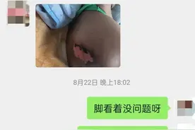 同学78岁的爸爸糖尿病，已经切除左下肢，如今右侧脚趾又发黑了图片