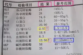 血生化检查报告单的解读图片