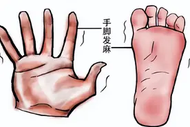 手脚麻木用好这味药，止麻、活血、通络图片