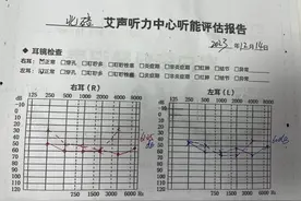 北碚艾声听力案例分享：年轻人听损带来说不出的伤图片