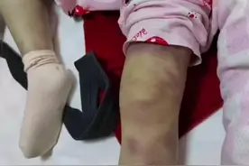 脑浆被打碎裂，6岁女童惨遭爸爸女友毒手，被刑拘，知情者发声图片