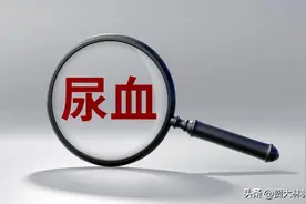 “为爱鼓掌”后“血尿”！专家提醒：此病男女都要警惕图片