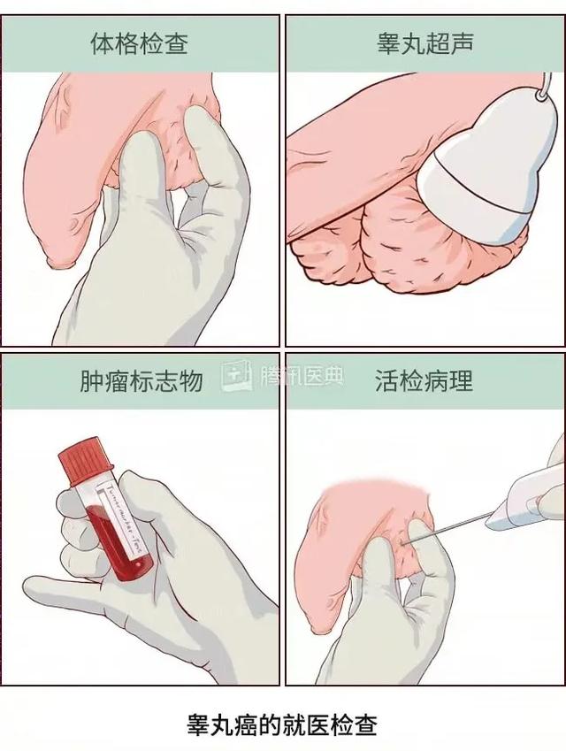为什么男生的蛋蛋，摸摸更健康？（女生勿进）