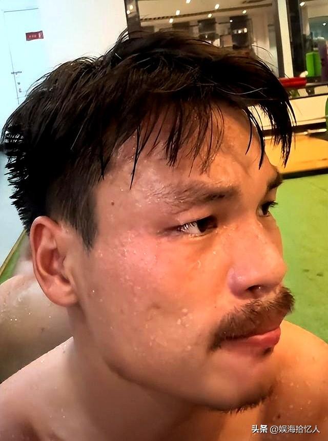被封一年后，小杨哥老婆“露头”探风口，医美痕迹和目的都很明显
