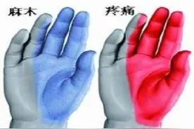 腕管综合征治疗方法图片