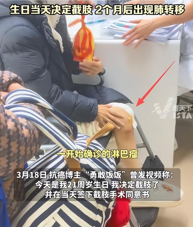 广东“天使女孩”梁希怡去世，仅21岁，生前被误诊，生日当天截肢