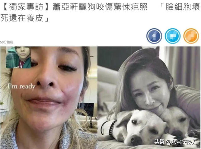 色字头上一把刀！“纵欲过度”的张雨绮，终走上萧亚轩的“老路”