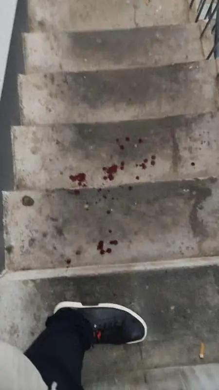 烈犬撕咬路人致其当场死亡，狗主人辩称：“人是被狗咬死的，我没罪”，法院：主人获刑6年半