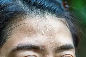 头汗出的多，阳虚，湿热要分清，简单两招，轻松止汗除湿热！图片