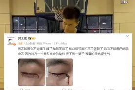郭艾伦晒眼部受伤流血照片，医生：结膜受伤及时就医多可得良好治疗图片