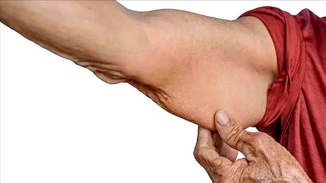 运动抗癌被实锤？美国哈佛证实：最好的抗癌运动！并不是走路跑步