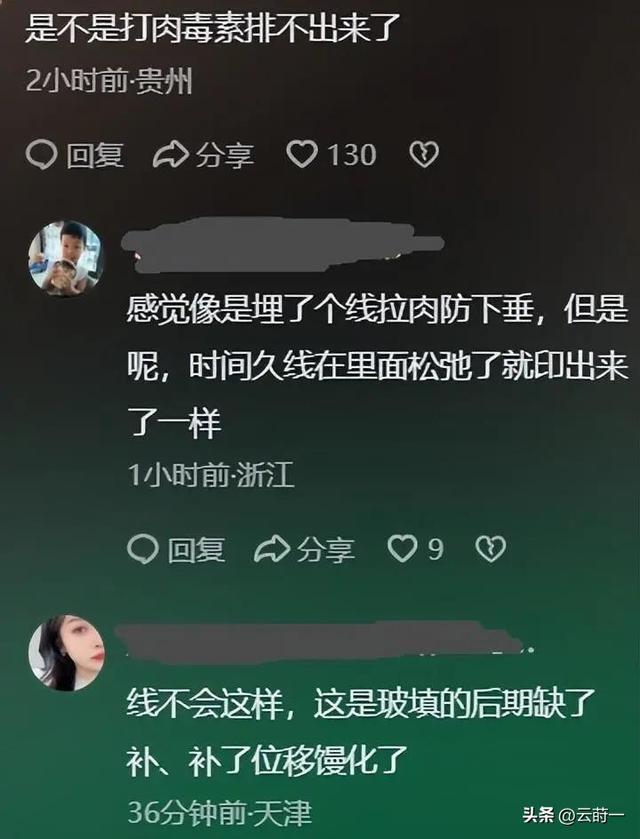 从“铁榔头”到“整容狂魔”，64岁郎平成了这样，差点认不出来了