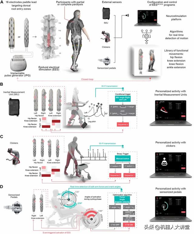 让瘫痪患者重新行走！脊髓电刺激+康复机器人 | Science子刊