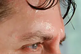 头面部出汗多，可能是这3种原因，找到病因，对症止汗！图片