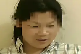 湖南罕见双性人：上半身女性下半身男性，做了29年男人选择做女人图片