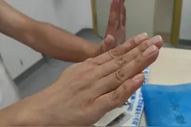 一觉睡醒后，手腕抬不起来了--桡神经麻痹是咋回事图片