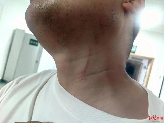 武汉一男子拍摄违停时被当街殴打，因不构成轻微伤，打人者被罚款500元，被打者称将提起行政复议并起诉