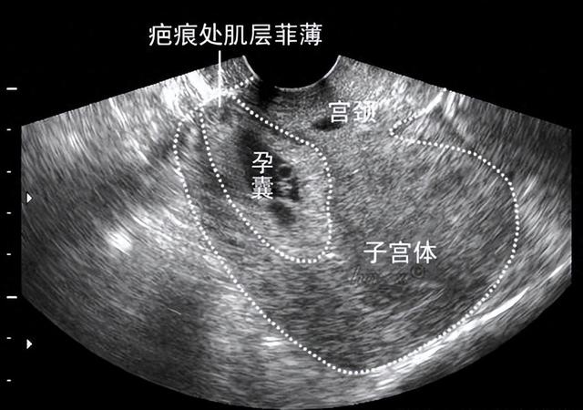 怀孕八个月,还能同房吗（孕妇怀胎8个月被老公请求同房）