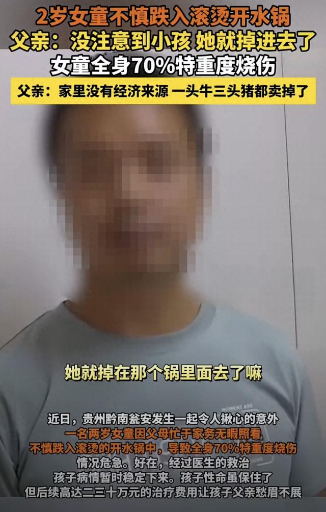 2岁女童跌入开水锅！70%烫伤背后，三秒疏忽一生伤痛