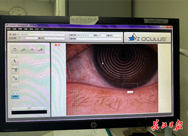 寻访武汉AI新势力 | 30秒视频生成报告，这家AI大模型企业眼科筛查准确率超医生