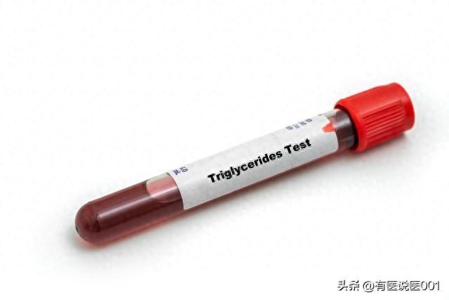 降甘油三酯最佳的中成药有哪些（高甘油三酯血症用药指南5种中成药与3种西药）