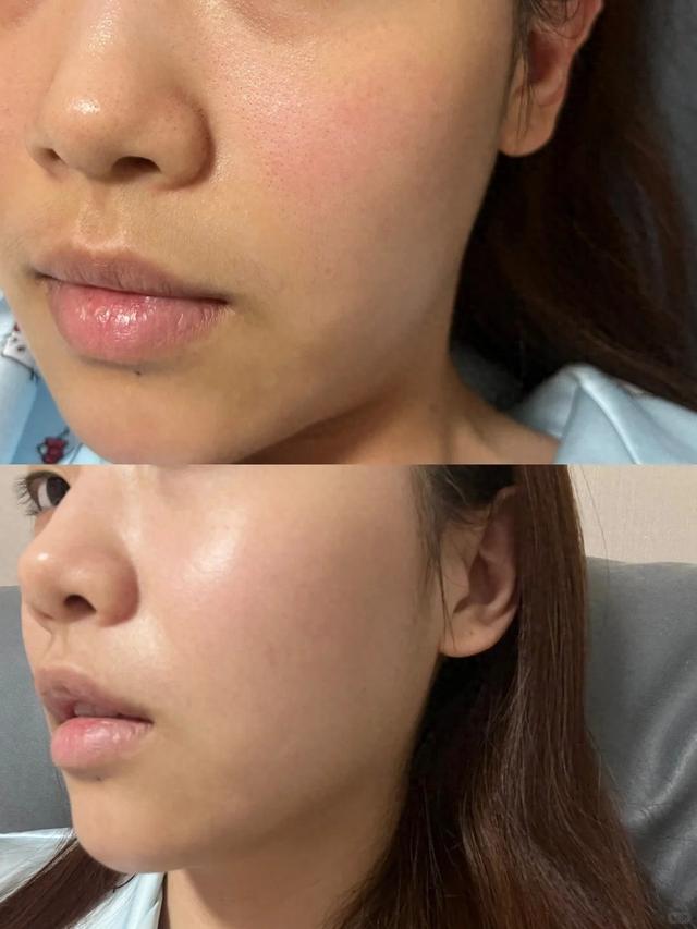 zeo优化（水悠季美白面膜登顶实测10款大牌涂抹面膜科学测评）