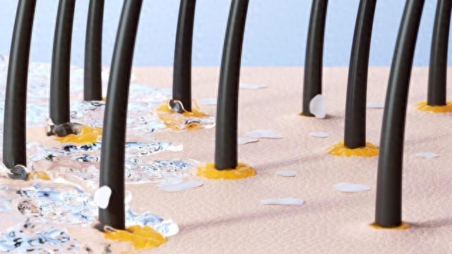 根优化（头皮细胞通讯网络优化仪专利间隙连接技术如何增强组织协调）