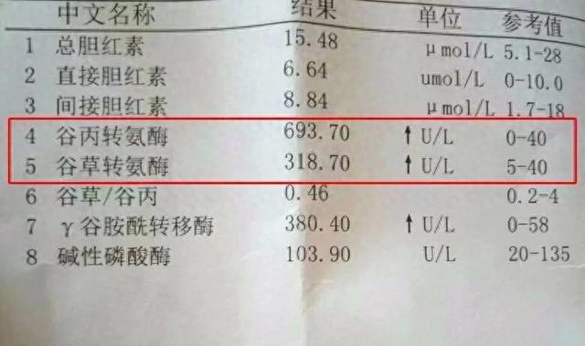 转氨酶升高别慌！记住“2吃3不吃”，肝悄悄变软！