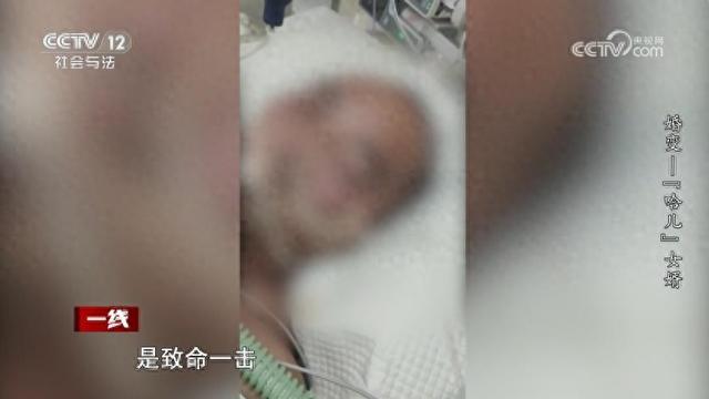 男子瘫痪2年多	，妻子出轨后怀孕并起诉离婚，作为被告，男子的法定代理人竟是他的岳父