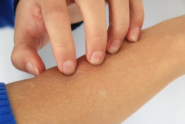 红斑狼疮早期症状有什么（红斑狼疮早期有哪些信号皮肤关节全身症状需警惕）