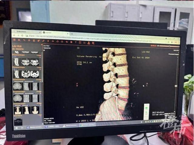 在海南参加冲浪培训，刚下水做了一个简单动作，就永久瘫痪了！男友在轮椅上坐了一年后，女友发声