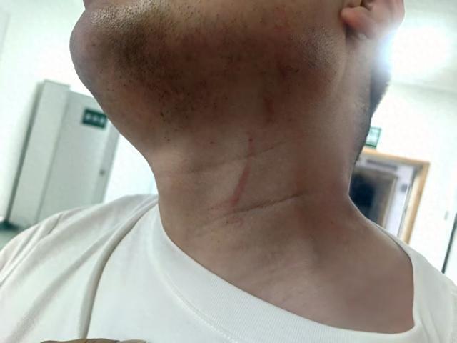 武汉一男子拍摄违章占道遭抢夺手机殴打,警方:不构成轻微伤,批评违章者并罚款500元