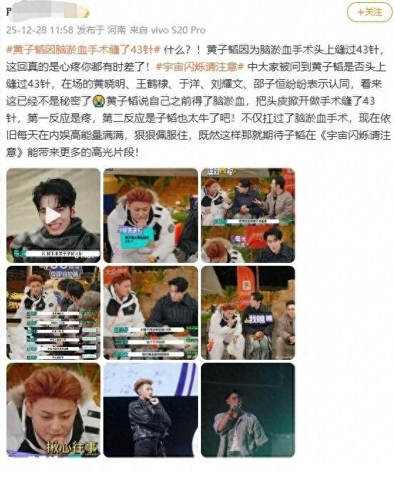 冲上热搜！黄子韬因脑淤血接受开颅手术缝了43针，本人回应