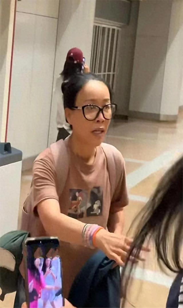 机场偶遇那英，脑门儿是填充了还是植发了？又肿又鼓有些不自然！