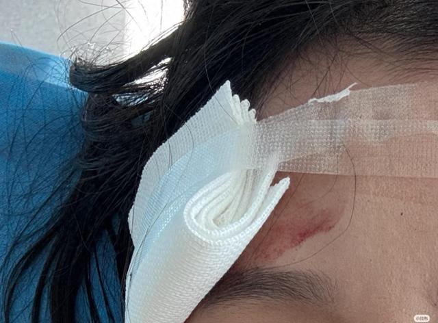 大连梅花鹿连撞两人，受伤女游客发声：我没招惹它，它突然冲过来！景区回应