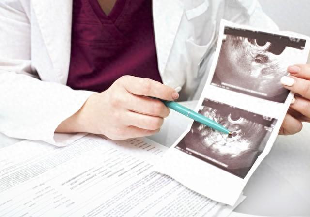 多囊卵巢要如何受孕（多囊卵巢难怀孕生殖科医生支招做好 3 点）
