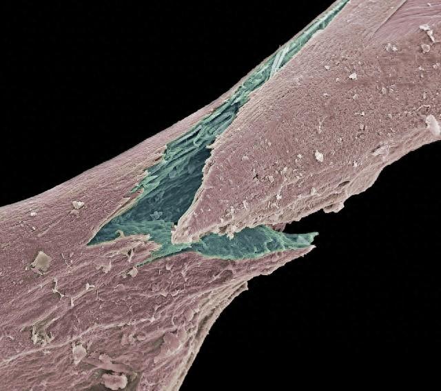优化机械设计（头皮组织张力平衡仪专利生物力学技术如何优化机械环境）